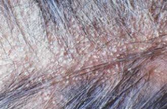 Scalp Problems fixed in Berkshire