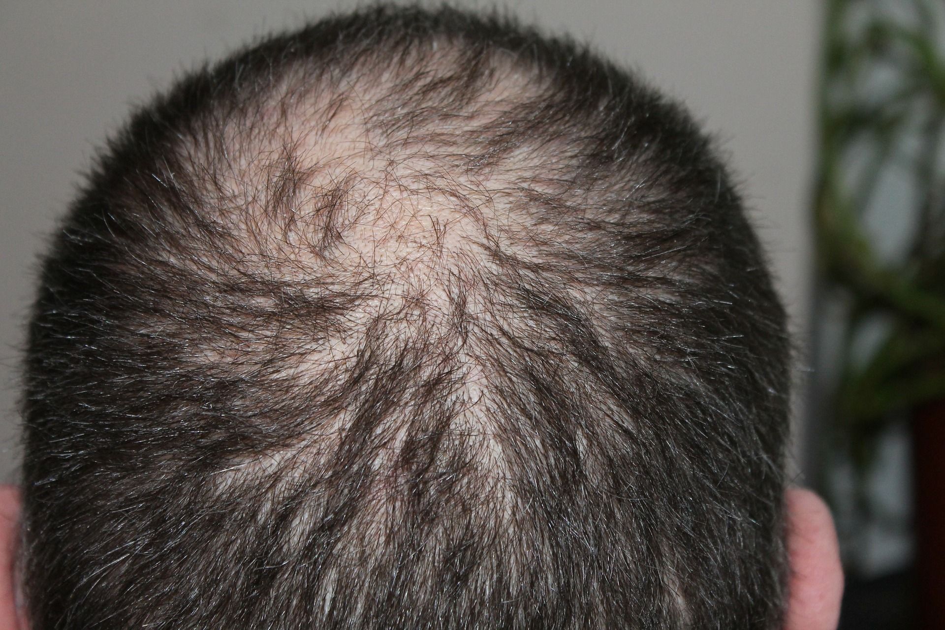 Beautiful-Hair Solutions - Hair Health & Vitality Clinic